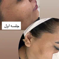 فیشال پاکسازی عمیق پوست