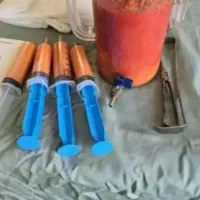 ساکشن شکم و پهلو