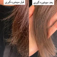 موخوره گیری همراه با پروتیین تراپی نیمه گرم