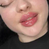 ژل و بوتاکس فردیس