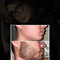 شیر به یالش مینازه/ مرد جذاب به ریشش