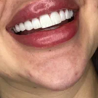 تخفیف کامپوزیت ۱۹۰۰ فقط تا ۳۰ اردیبهشت
