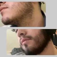 قدرت چهره مردانه تو ریش سیبیله پرپشتشه
