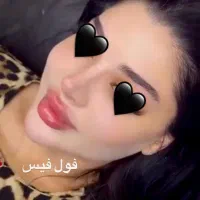 تخفیف در کلینیک تزریق فیلر و بوتاکس