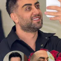 تخفیف ویژه همدلی کاشت مو و ابرو