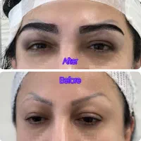 کاشت ابرو دائمی در رشت-پرداخت دومرحله ای