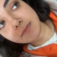 تزریق تخصصی ژل لب روسی و نچرال|خدمات آرایشگری و زیبایی|ارومیه, |دیوار