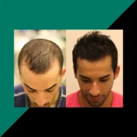 از ریزش تا رویش