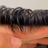 پروتزمو/شرایط ویژه پرداختی
