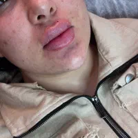 خدمات پوست مو بوتاکس فیلر