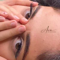 مدل میکروبلیدینگ