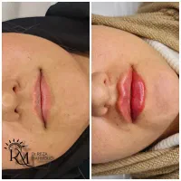 جشنواره یلدایی زیبایی کلینیک دکتر محمودی