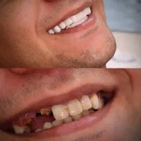 اسنپ ان اسمایل.اصل.لمینت متحرک