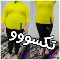 لاغری بدون ورزش و رژیم سخت