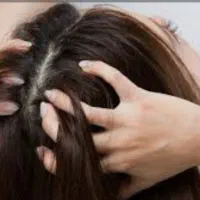 رفع آنی رشک و شپش با دستگاه