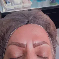 میکروبلیدینگ