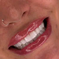 تخفیف 70% کامپوزیت ونیر و لمینت