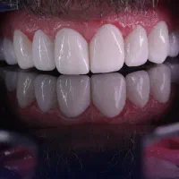 شرایط ویژه فقط با ۳ میلیون کامپوزیت کنید