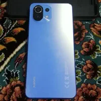 شیاومیmi11 لایت