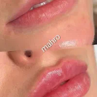 مدل برای ژل لب و کانتورینگ صورت