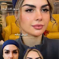 پکیج طلایی نقره ایی برنز لیفت با فیلر ژل بوتاکس