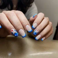 کاشت اولیه فقط 400