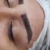 میکروبلدینگ/فیبروز/نانوبروز
