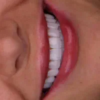 کامپوزیت ماهیانه ۱۷۵ هزار تومان با اقساط ۱۲ ماهه