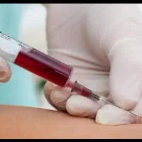 آموزش تزریقات و سرم تراپی ، مهارت طب سنتی