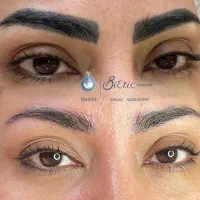 آموزش و خدمات حرفه ای ریموو تتو