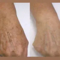کرم دست بیوممتیک