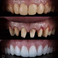 اموزش جامع دندان پزشکی و دندانسازی