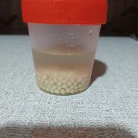 تخم حلزون(خاویار حلزون)