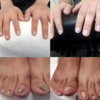 مانیکور پدیکور تخصصی در محل کار منزل یا سالن