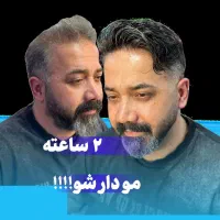 پروتزمو /ترمیم مو/ پروتزمو اقساطی در اصفهان