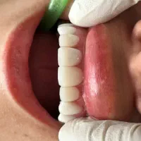 دستیار دندانپزشک (آموزش،استخدام)