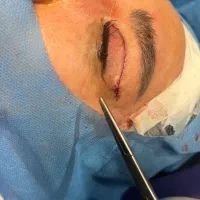 تکنسین اتاق عمل