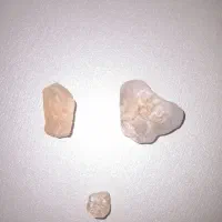سنگ