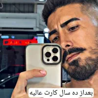 جشنواره جراحی بینی هزینه  ۳۵ میلیون