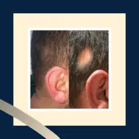 از ریش تا ریشه