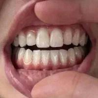 ایمیلت 5 میلیون سفته