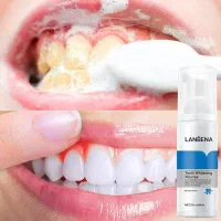 سرم سفیدکننده دندان مدلMegaWhite/سفیدی فوری