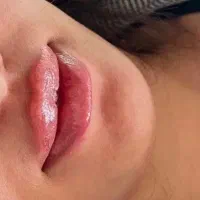 جشنواره مدلینگ ۱۰ سی سی فیلر فقط تا آخر هفته