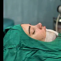 عمل بینی ۳۰ میلیون