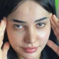 جشنواره ویژه کاشت ابرو طبیعی با اقساط ۵ماهه تضمینی