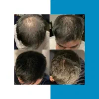 وقتشه دیگه کچل نباشی
