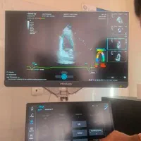 فروش اکوکاردیوگرافی Mindray Consona N9
