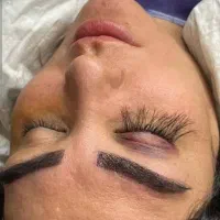 کاشت طبیعی و‌دائمی مژه و ابرو