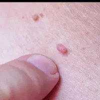 h.hدرمان|آرایشی، بهداشتی، درمانی|شوشتر, |دیوار