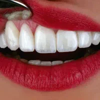 کامپوزیت از دم قسط